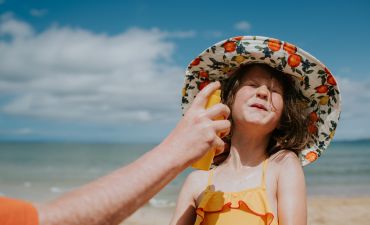 domowe sposoby na oparzenia słoneczne